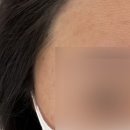 밀스칼프 이미지