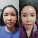 #쏠베라 찐~후기