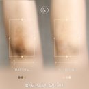 루리스킨