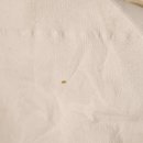 비립종제거랑 독감예방주사후 감기몸살 앓다. 이미지