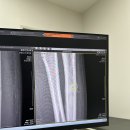 상봉퍼스트본정형외과의원 | 상봉역 정형외과 추천/ 상봉 정형외과 좋은곳 / 상봉역 친절한 정형외과