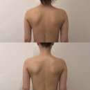 마산피부관리 쎌뷰티 순환의 기본 등관리 후기