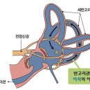 독일탑보청기