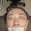 한화장반점 | 창원 피부과 내돈내산 피코프락셀 라비앙 제네시스 레이저 피부과 시술 후기 총정리