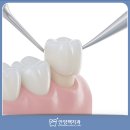 맥치과기공소 이미지