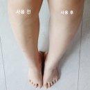 앤니 이미지
