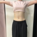강남 복부지방흡입 4개월차 후기 / 체중, 허리둘레 변화 총정리