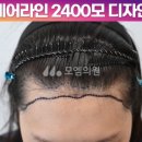 중앙헤어라인 이미지