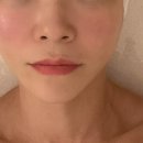 윤슬 에스테틱 검단 피부관리