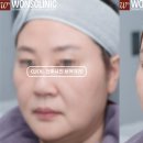 실루엣의원 이미지