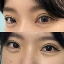 애뷰리띵