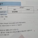 자궁경부세포진검사 양성이면 심각한건가요? 이미지