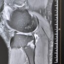 삼성본프라임정형외과의원 이미지