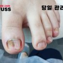 레푸스 사상점 이미지