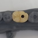 수인치과기공소 이미지