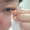 세정기업 | 눈꺼풀 세정제 추천 헬로아이즈 아이더마, 사용법 효과 마이봄샘 세정 후기