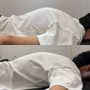 국대교정 | 키 성장이 더디다면 ? 청라체형교정에서 성장판 닫히기 전에 확인해야 할 것