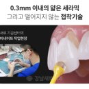 새로치과기공소 이미지