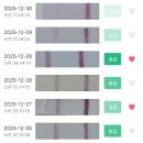 로이여성의원 | [임신일기1] 배란테스트기 안 맞아서 배란초음파 본 후기(feat. 난포주사)