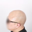 디비전 스칼프 | 진짜 모근같이 자연스러운 커버, 삭발두피문신 전문 디비전스칼프