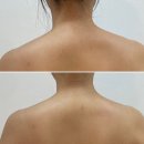 울산웨딩관리 쏭뷰티 좌우비대칭 케어 최고