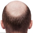 아이스캡