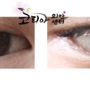 코리아의안센터 티스토리