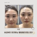 지에스25군산조촌로점 | 군산피부관리 추천 수송동 보금뷰티 피코토닝 물방울리프팅 관리