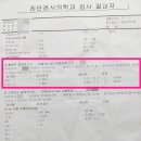 의료법인칠석의료재단사랑의병원 | 갑상선항진증 완치한 병원 추천, 3개월 만에 완치 후기