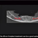 웰컴치과기공소 이미지