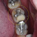 다대2동-3 이미지
