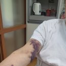 양천어르신 요양센터 | 화장실 낙상 사고와 예방의 중요성, 그리고 달라진 어르신의 하루– 남양주 방문요양센터 후기