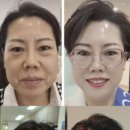 찬스인셀덤