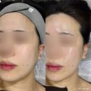 신갈마로-7 | 대전 갈마동 피부관리 에이아이앤비뷰티 재생관리 후기 겨울 건조함에 딱