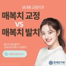 연세신경과의원 | 성내동 교정치과 매복치교정 vs 매복치발치, 어떤 치료가 필요할까요?