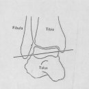 발목 불안정의 기능 해부학, 병리학... 이미지