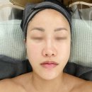 고운동피부관리 한번에 예뻐지는 델라뷰티 플라샤워 후기