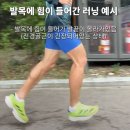 러닝할때 종아리 앞쪽 정강이 아프신분들 요거 봐보세요 (신스프린트) 이미지