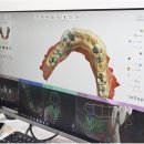 틀치과기공소 이미지