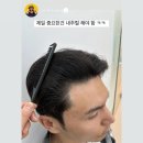 제이케이패션(JK FASHION) | 광주모발생장 광주탈모전문 JK두피부띠크에 방문한 헬창 안시현님 후기
