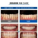 더스마트치과기공소 이미지