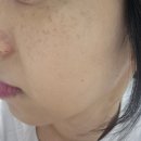 씨엘 | 안양 피부관리 물광관리후기 씨엘오비스 안양범계점