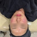 부산 서면피부과 신상리프팅 올타이트 잘하는곳 400샷 즉각효과 솔직후기