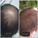 H.B.(꿀벌)동물병원 | 머리카락의 집, 영양 공급 배선인 모낭이 비면 안 되는 이유 탈모 고민 해결-(주)나와모랩