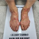 피부하임
