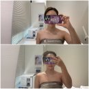 청라피부관리 뷰티팬지 에스테틱 / 대만족 안아픈 필링 후기