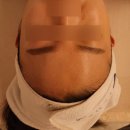 세연메디칼 | 진해웨딩관리 예담에스테틱 &#39;세멘부스팅&#39; 피부도로공사 후기
