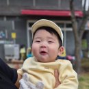 [청주,오송] 아기 얼굴 화상 베스티안 병원 후기 및 화상 관리 방법