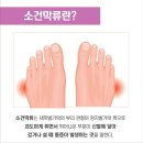 닥터발가락 이미지