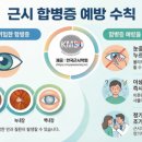 바른아이안경, 콘택트 이미지